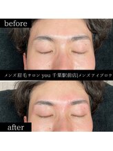 ユー 千葉駅前店(you)/ビフォ－アフター写真