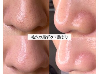 ル シーニュ 豊田市の写真/【今日も毛穴から目が離せない】気付けば鏡を見るたび毛穴をチェック…。そんな毎日を終わりにしませんか？