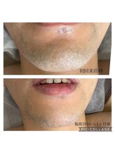 グラース(grace)/