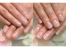 アルテミス(ARTEMIS)/深爪育成コース