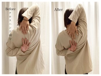 ワン ストレッチ(ONE stretch)/【30代女性before・after】