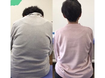 りょうたろう整体院/長年悩んでいた姿勢の悪さが！？