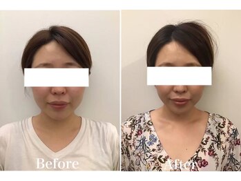 池袋東口整体院/全身整体×小顔矯正