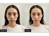 【◎美人・イケメン度UP◎】小顔矯正初めての方！小顔矯正 60分 ¥12000→6000