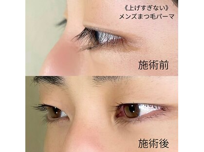 デフィ(Defi)の写真