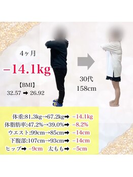 ベルソー鍼灸整体院(berceau鍼灸整体院)/30代女性ダイエットコース