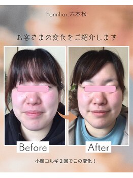 ファミリア(Familiar.)/小顔コルギ(デコルテ・ヘッド付)