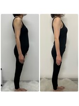 シャルム(Charme)/骨盤矯正