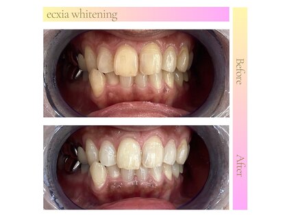 エクシアホワイト 山形西バイパス店の写真