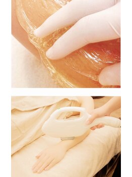 カラ(CARA)/腕ダブル脱毛♪ハーフorオール