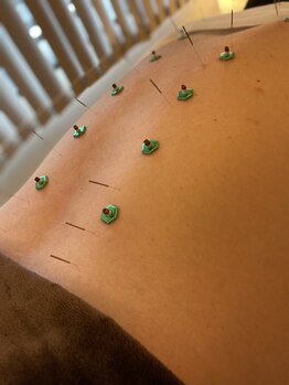 リハリ 本町院(///Rehari)/お身体鍼灸