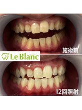 ルブラン 奈良店(Le Blanc)/ツルツル、ピカピカ！