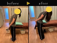 杉本接骨鍼灸院/背骨から全身がユルユル整体