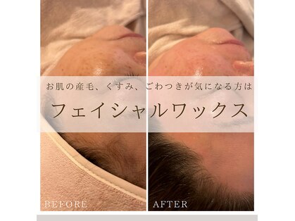 ワクシングアンドビューティーワイ(Waxing&Beauty_Y)の写真