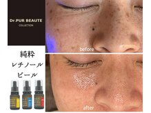 マイルーチェ 可児川合店(MyLuce)の雰囲気（あらゆるお肌のお悩み改善♪）