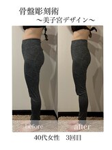 マージェ(magie)/新技術☆骨盤美子宮デザイン