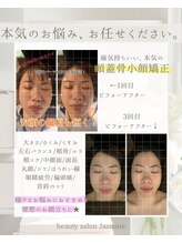 ジャスミン(Jasmine)/頭蓋骨小顔矯正