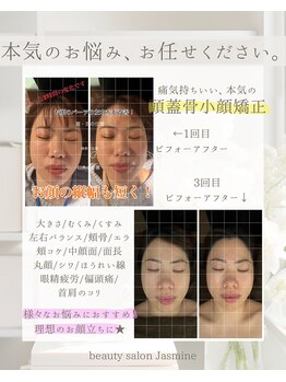 ジャスミン(Jasmine)/頭蓋骨小顔矯正