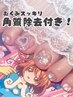 ☆☆¥2000お得☆☆【フット/10本アート+角質除去】おまかせコースゴテゴテ