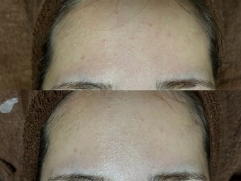 リボーン(REBORN)/大きなお悩みになる前に！