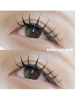 ビュー(V.I.E.W)/BIND LOCK100束