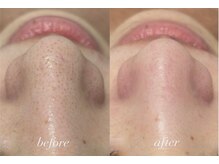 ラポール 野並店(Rapport)/