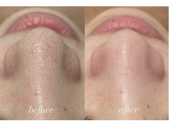 ラポール 野並店(Rapport)/