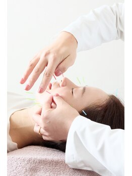 インヤン(yinyang)の写真/美容鍼で肌の内側から改善！30代からのたるみケアに◎お肌の土台作りで若々しい見た目へ導きます＊