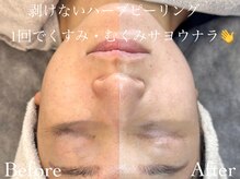 ルチーレ(Lucire)の雰囲気（剥けないハーブピーリングは様々な肌悩みを細胞レベルから改善）