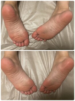 グランシャリオ(GrandChariot)/ボディ60分1回での施術変化！◎