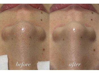 ラポール 野並店(Rapport)/