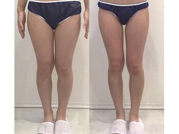 リラパドマ 千葉店(Rela Padma)/激痩せ短期集中ダイエットコース