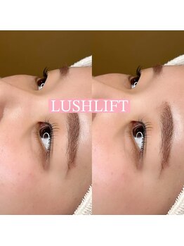 リンド エステ まつげ 京成大久保(Lind)/ラッシュリフト