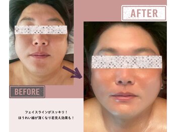 マーリエ(Malie)/【メンズ小顔】