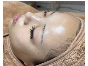 ドゥーソル 谷町四丁目店(due sole)/エクソソームハーブピーリング