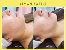 ハノハノ 八代店(HANO HANO)/【八代初導入！】レモンボトル☆