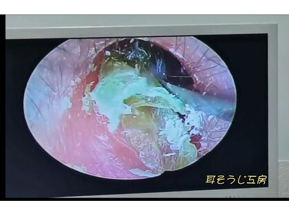 耳そうじ工房 小田原店の写真