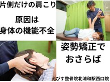 えびす整骨院 北浦和駅西口院/片側だけの肩こりは機能不全？！