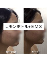 ヴィヴ 三島店(Vive)/《レモンボトル＋EMS》