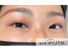 アンドリタ/超ダメージレス　マツパ