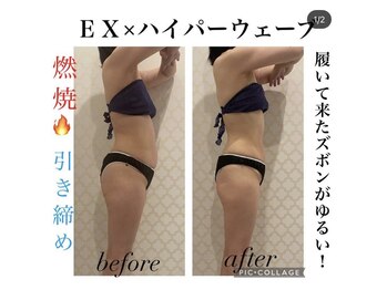 シャルム(CHARME)/ハイパーナイフ優良認定店！