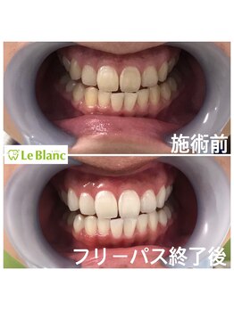 ルブラン 奈良店(Le Blanc)/学生のお客様!