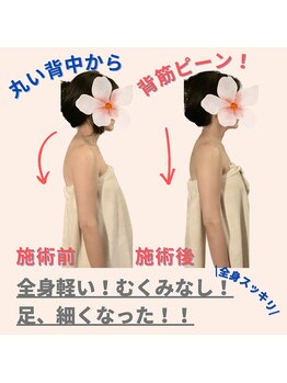 ミトラ(MITRA)/全身のむくみ、だるさスッキリ！