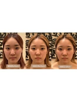 アジール 新潟市(agir)/Before/After画像