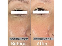 リラクゼーションサロン トゥジュール(Tujuhl)の雰囲気（発光美艶ピーリング♪肌質を良く◎古い角質を浮かして排除◎）