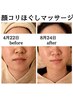 【毛穴・小顔】毛穴洗浄＆マッサージ＋顔ほぐしマッサージ+高濃度美容液導入