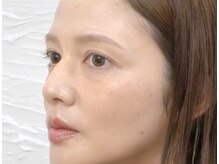 ビメ 中央林間(BEME)/【眉×眉カラー×まつ毛パーマ】