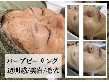 ピュアル 川口(Pual)/【毛穴/美白】バーブピーリング