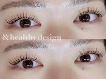 ユーロ(EURO)/アンドヘルシー