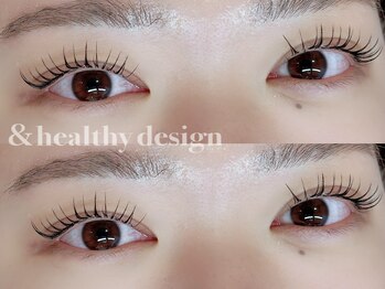 ユーロ(EURO)/アンドヘルシー